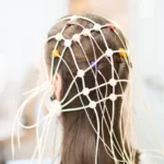 Women with brown hair in a medical clinic getting an EEG brain scan.
