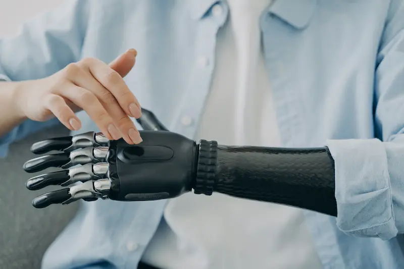Disabled woman turning on her bionic hand prosthetic.